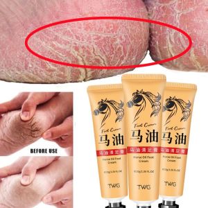30g Horse Oil Hand Foot Cream Anti-Aging Horse Oil Dry Skin Care Moisturizing Whitening Cream anti-cracking cream Peeling Whitening Repair Moisturizing Whitening Hand Cream Hydrating Anti Chapping Skin Repair hand cream foot cream