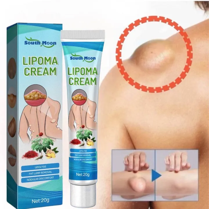 SOUTHMOON%20LIPOMA%20REMOVAL%20CREAM%20krim%20pembersih%20lipoma%20limfa%20ketulan%20keras%20ketiak%20leher%20belakang%20telinga%20buang%20detox%20badan%20-%20Image%206
