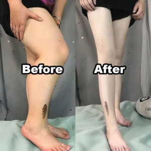 ✨แนะนำโดยอินฟลูเอนเซอร์✨ South Moon แผ่นแปะลดไขมัน แผ่นแปะเผาผลาญไขมัน ครีมเผาผลาญไขมัน แผ่นแปะลดต้นขา แผ่นแปะลดต้นแขน ลดต้นขาใหญ่ ลดไขมันต้นขา กำจัดไขมันต้นขา