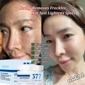 377 dark spots remover cream krim pemutih wajah 50g niacinamide 美白祛斑霜 moisturizer brightening Anti pigmentation dullness Freckles Melasma sunburn Age Spots
