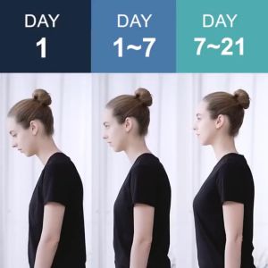 Smart Posture Corrector: Hunchback Correction & Round Shoulders Chest Support