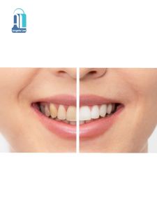 Enzim Fresh Mint Toothpaste Pasta Gigi Tanpa Detergen Bebas Bau Mulut