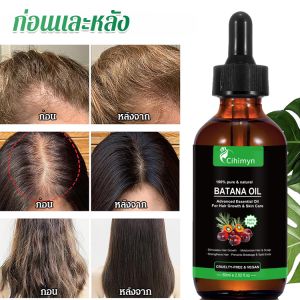 น้ำมันหอมระเหย การเจริญเติบโตของเส้นผม สาระสําคัญ