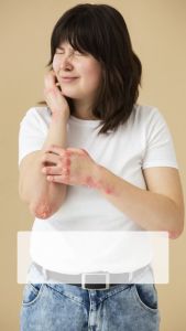 Obat Gatal Kulit Herpes Kusta Lepra Herbal Original 100% DEMAXIO BHARATA