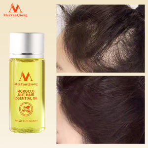 MeiYanQiong Fast Powerful Hair Growth Essence Hair Loss Products Essential Oil Liquid  Preventing Hair Loss Hair Care Products 20ml