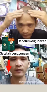 SWEETRIPGinger King Serum Anti Botak Rambut Lebat Sehat BErkilau-Penumbuh Rambut Secara Cepat/Penyubur Rambut Rontok Pria- PELEBAT RAMBUT - PENUMBUH RAMBUT BERKHASIAT - MENGHITAMKAN RAMBUT- PENUMBUH RAMBUT MANJUR