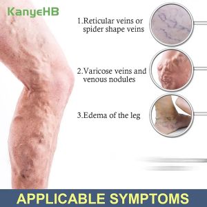 LaSeller Ready Stock 20G Varicose veins Varicose veins cream Varicose veins treatment Varicose veins remover Varicouse veins remover Varicose vein removal cream Vein Pain Effective Healing Cream