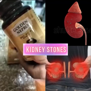 (BUY 2 GET 1 FREE) Golden Nepro Help for Kidney Stone and Gallbladder 30Capsules