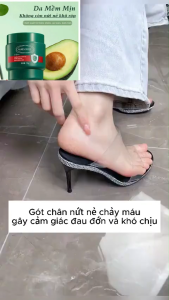 Kem Bôi Nứt Nẻ Gót Chân Bàn Tay MAIGOOLE - Kem MAIGOOLE Bôi Giúp Cải Thiện Khô Nứt Trên Da Tái Tạo Lại Làn Da