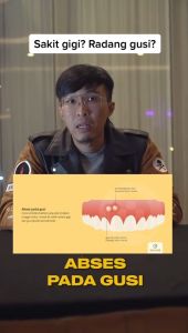 Obat Sakit Gigi Berlubang Ampuh Penghilang Gusi Bengkak Linu Bernanah Nyeri Sariawan Anak Dewasa