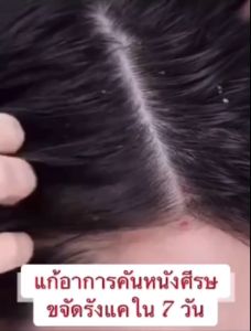 ALIVER Sea Salt Shampoo 200ml - Dandruff Relief Scalp Soothing Hair Loss Prevention Oily Hair Care