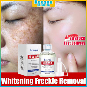 ⭐️𝗦𝗚 𝗦𝗧𝗢𝗖𝗞⭐️ Niacinamide anti freckles cream / Whitening serum face brightening / Melasma dark spot / Freckles removal serum 美白祛斑精华液