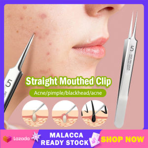 Ultra-fine No. 5 Cell Pimples Black Head Clip Tweezers Acne Removal Needles 粉刺针去黑头夹 闭口挑挤痘祛痘针工具 Stainless Steel Beauty Face Cleaning Care Tools