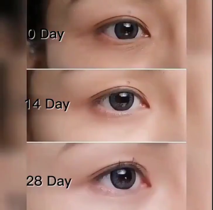 Cordyceps sinensis Fat Granules Remover Eye Cream Effective Remove Fat Granules Puffiness Anti-Particles Milia Remover Product Repair Eye Skin Care 30g