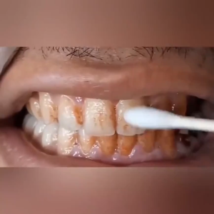 EELHOE Teeth Whitening Essence Powder Oral Hygiene Cleaning Serum Removes Plaque / Pemutih Gigi Kuning dan Karang Permanen / Pembersih Perontok Karang Gigi dan Bau Mulut / Dazzling White Pen