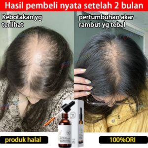 Serum Pertumbuhan Rambut 60ml serum anti rambut perontok penumbuh rambut cepat Mencegah Kebotakan