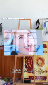 Tranh nha khoa thẫm mỹ tranh khám răng nha khoa Tranh Nha Khoa khám răng vệ sinh răng miệng tráng gương NKQC37