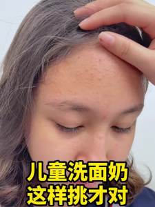 青少年洗面奶控油祛痘收缩毛孔深层清洁去油学生青春期洁面乳CA Adolescent Facial Cleanser Oil Control Acne Removing Shrink Pores Deep Cleansing Oil Removing Student Adolescence Facial Cleanser CA