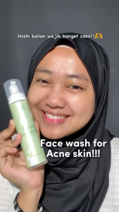Hazel Blemish Face Wash Foaming