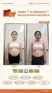XLIMIX PRO Japan Formulated Carb Blocker | Block Sugar & Fat Support Weight Management