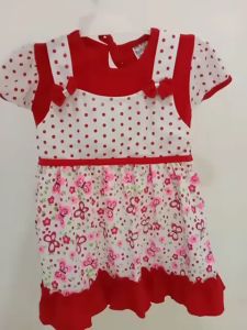 Cara Memilih Baju Rok Bayi 3-18 Bulan yang Nyaman & Elegan