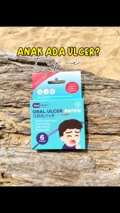 Mouth Ulcer Patch Pelekat Ulcer Mulut AcuMEDI Oral Ulcer Patch for Ulcer Treatment