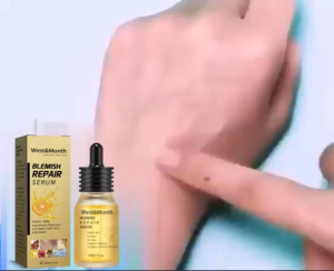 West&Month Freckle Care Serum Serum for Skin Brightening เซรั่มดูแลฝ้าและกระ เซรั่มบำรุงผิวเพื่อความกระจ่างใสและดูแลริ้วรอย ริ้วเล็ก จุดด่างดำ