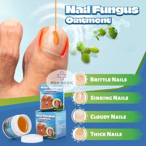 Cream Perawatan Kuku Original - Nail Fungus