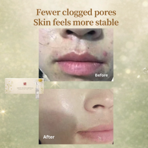SKIN360 Smart Repair Ampoule | Deep Hydration | Skin Barrier Repair | B5+ NMF+ CHA+ | 10 Bottles per box