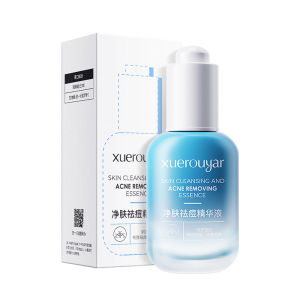 Xuerouyar Gentle Blue Bottle Acne Treatment Essence Liquid Facial Pimple Mark Lightening Skincare for Dry Oily Neutral Skin
