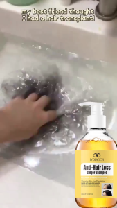 Ginger Anti-Hair Loss Shampoo 300ml Rapid hair growth Antidandruff Oil Control Moisturizing Softening Hair