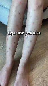 EVOKE Body Wash Coastal Journey: Sabun Cair untuk Kulit Sensitif & Luka Kering (300ml)