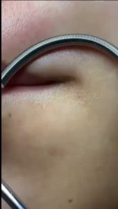 PERAWATAN WAJAH ALAT PENCABUT OTOMATIS BULU HALUS & FACIAL KULIT WAJAH SIMPLE CEPAT HASIL MAKSIMAL FACIAL HAIRS  BAHAN STAINLES ANTI KARAT