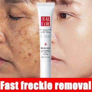 🔥Fast Effective Freckle Removal Whitening Cream Melasma Removal Cream Original Pekas Remover Serum Anti Melasma And Dark Spots Cream Face Skin Care Whitenight Cream Face Moisturize 20g LovelylifeFu👍