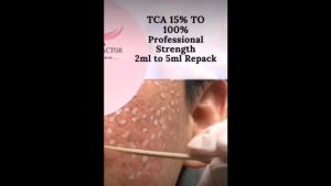 TCA Peel Repack Ori 50% from 3ml Chemical Peeling