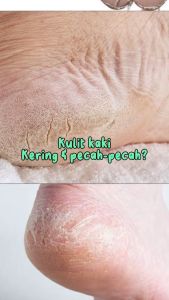 Azalea Smooth Foot Cream 35 Gr: Solusi Perawatan Kulit Kaki Kering & Kasar