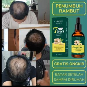 (Bisa Cod) BPOM Serum Penumbuh Rambut Cindynal Of Ginger Clothes Of Skin 7 Days Ginger Germinal Oil Penumbuh Rambut Botak 30 Ml Perawatan Rambut Rontok Bpom Daimanpu Serum Ginseng - Lazada