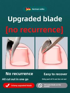 MONLEYTA | German Nail Clippers Pedicure Tool Set Large Sharp Nose Angle Mouth Foot Care Household Essential Manicure And Pedicure Tools