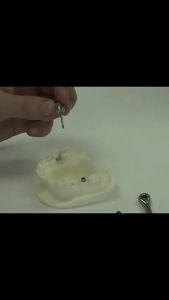 Dental Implant Torque Wrench Screwdriver Prosthetic Kit Dental Instrument Autoclavable 16Pcs/Set Restoration Tools