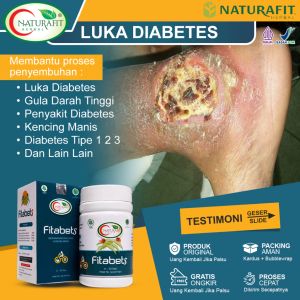 Obat Gula Darah Luka Diabetes Kencing Manis - Fitabets 50 Kapsul ORi