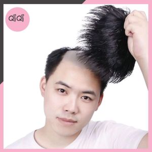 Tóc Giả Che Hói Cho Nam Phong Cách Trẻ Trung QiQiShop