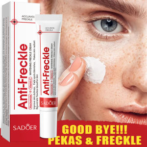 Whitening Freckle Cream 20g Penghilangkan Bintik Gelap Anti Bintik Niacinamide Memudar Pigmentasi Melasma Dan Mencerahkan Krim COD