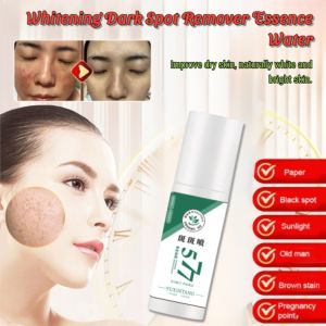 Anti-Freckle Essence Oil Reduce Wrinkles Anti-Aging Serum Whitening And Freckle Removal Spray