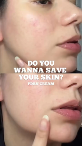 REJUALL Cream Advanced PDRN 20ml - Skin Rejuvenation & Repair - Anti-aging & Collagen-Boosting Formula