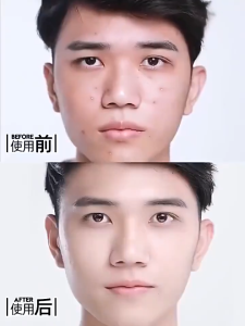 Sữa rửa mặt trị mụn sữa rửa mặt sữa rửa mặt sữa rửa mặt axit salicylic 100g nhanh chóng loại bỏ mụn trứng cá khơi thông lỗ chân lông kháng khuẩn chống viêm giảm đỏ