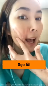 Kem Thảo Mộc Phục Hồi Sẹo Làm Mờ Sẹo Lâu Năm Ngăn Ngừa Hình Thành Sẹo Giảm Sẹo Giảm Sắc Tố Da Phục Hồi Sẹo An Toàn & Hiệu Quả Làm Mềm Da Tăng Độ Đàn Hồi Cho Da  Giúp Da Căng Bóng Và Mịn Hơn Da Khỏe Mạnh Công Thức Nhật Bản 30g | Moska