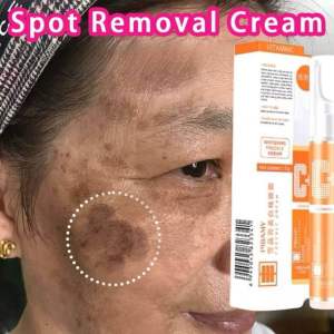 SKIN Tag remover Mole corn remover krim penaggal ketuat kutil tahi lalat jeragat freckle remover cream