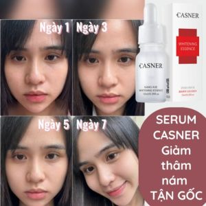 [ CHÍNH HÃNG ] Serum CASNER Abutin TRẮNG DA MỜ NÁM giảm thâm námđều màu da trắng bật tone