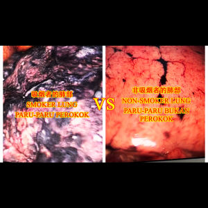 REX & LEO Series - Kawasato Japan Filter Holder 50pcs Per Pack/Box