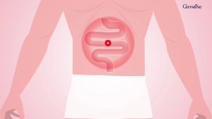 (ส่งฟรี )โพรไบโอติก 10 พลัส กิฟฟารีน ขับถ่าย ลำไส้สะอาด ท้องอืด ท้องเฟ้อ